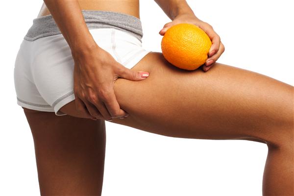 What-causes-cellulite (Custom)