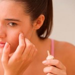 Getting-rid-of-pimples (Copy)