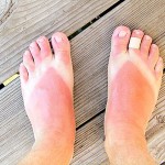 bad-sunburns-flip-flops-477 (Copy)