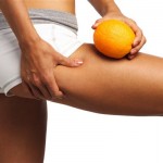 What-causes-cellulite (Custom)