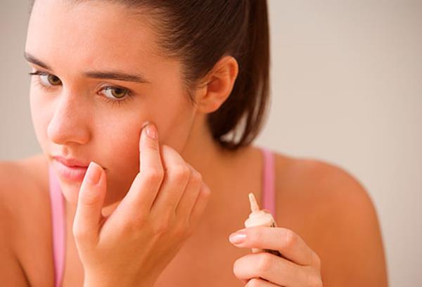 Getting-rid-of-pimples (Copy)