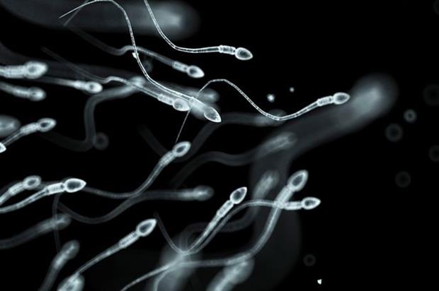 Human-sperm