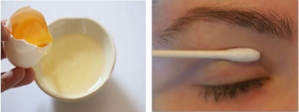 Treat-Your-Droopy-Eyelids-Naturally-and-See-the-Amazing-Results-in-Just-3-Days-1 (Copy)