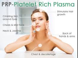 PLATELET RICH PLASMA (PRP) - Aesthetic Rejuvenation Center